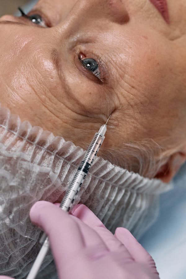 Injection de Botox : rajeunissez votre regard en 15 minutes